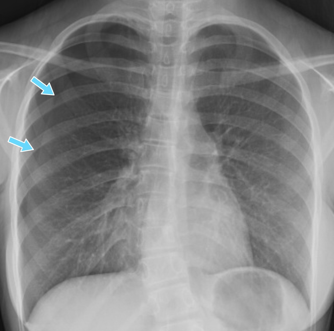 What's the diagnosis? By Dr. Abby Renko EM Daily